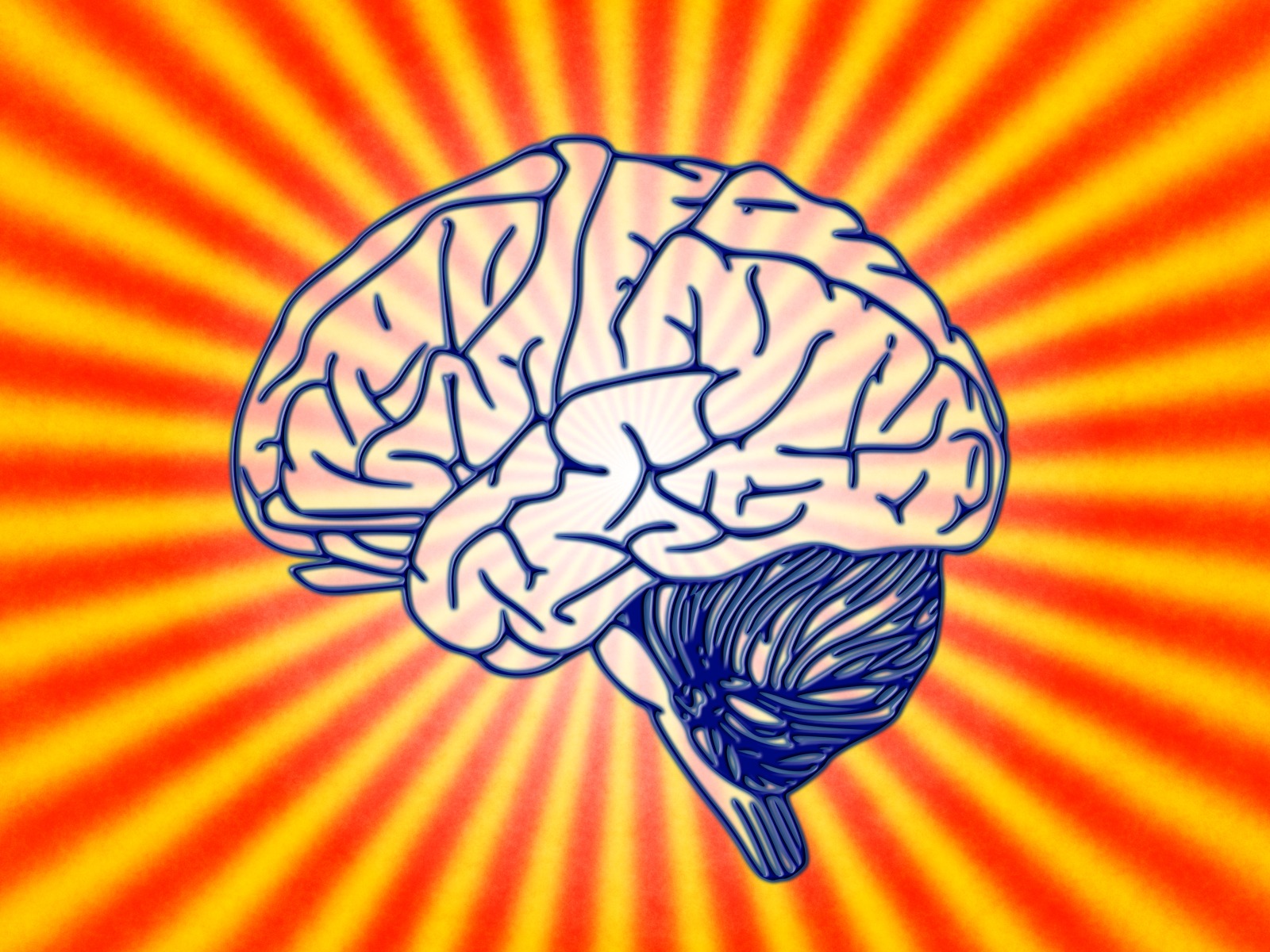 Pictures of bipolar brains Pictures of bipolar brains