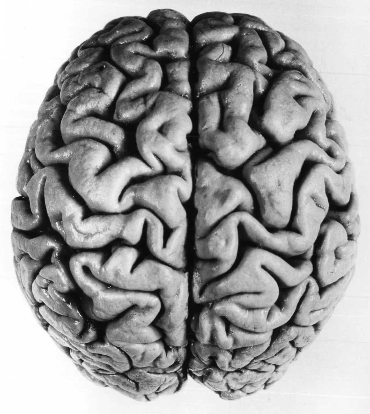 A human brain seen from above with its folded surface