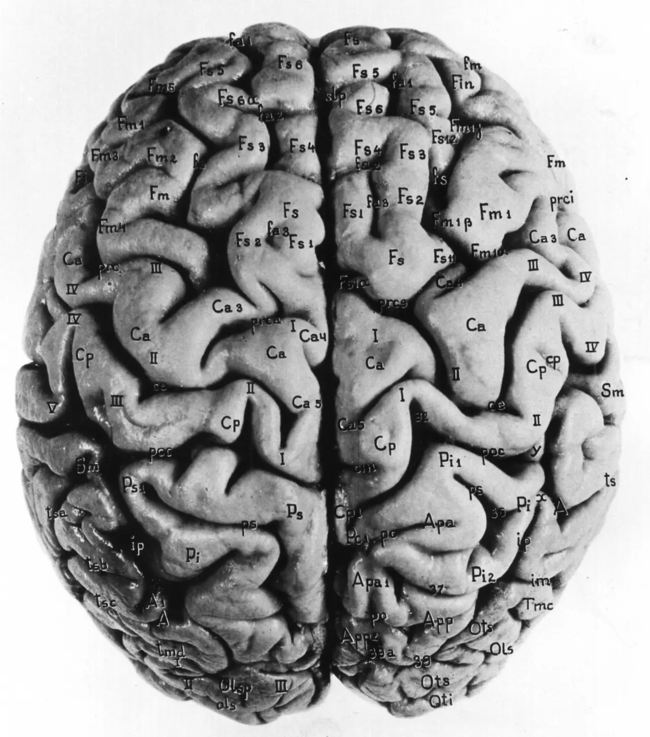 Top view of a human brain with its folded surface