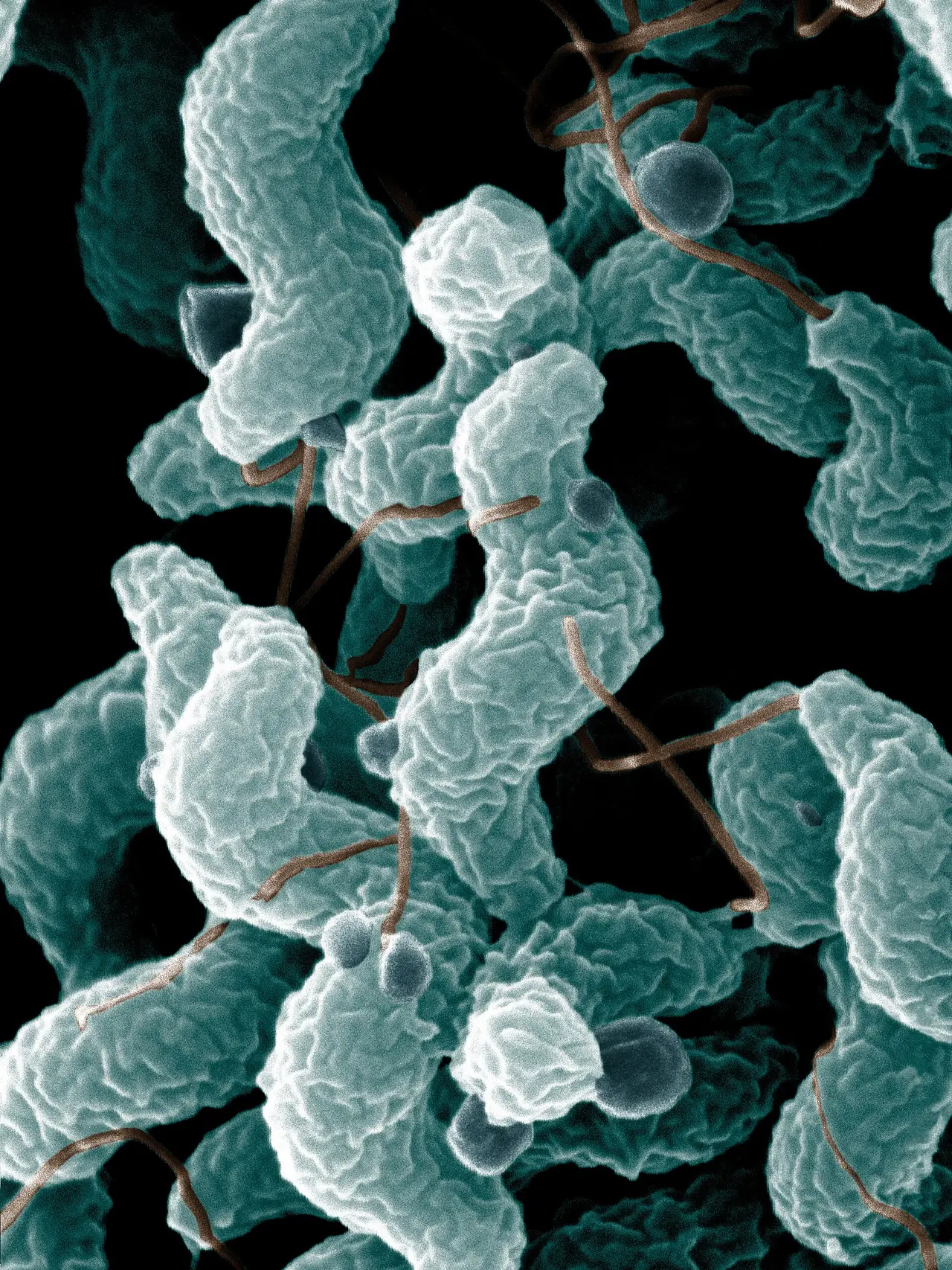 Teal-coloured curved bacteria magnified under an electron microscope