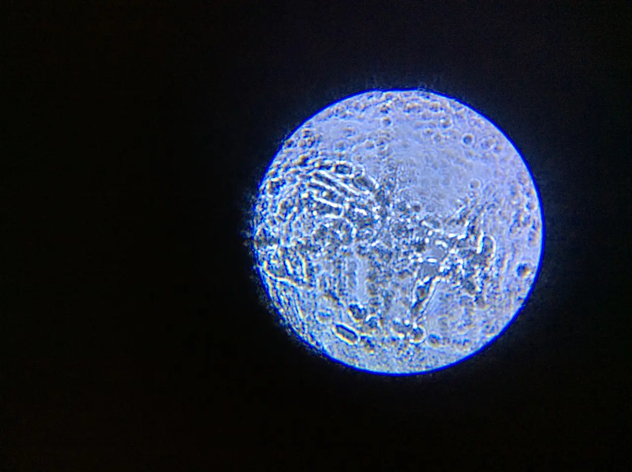 A bright circle on a dark background showing a microbe magnified through a microscope
