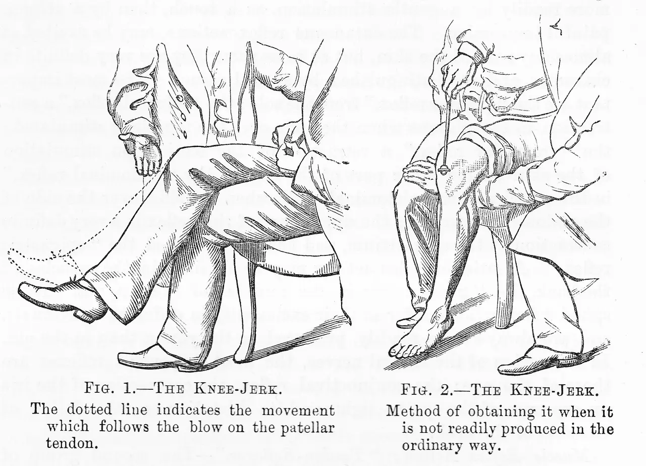 Two engraved figures of a seated person showing the knee jerk test
