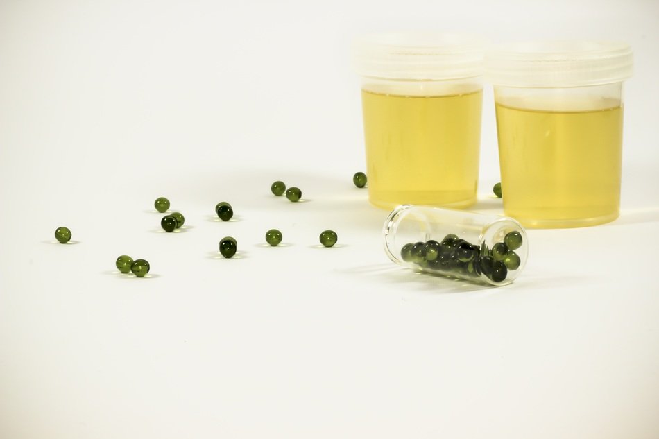 Test containers with urine for analysis