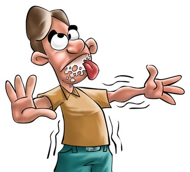 Seizure Epilepsy Symptoms