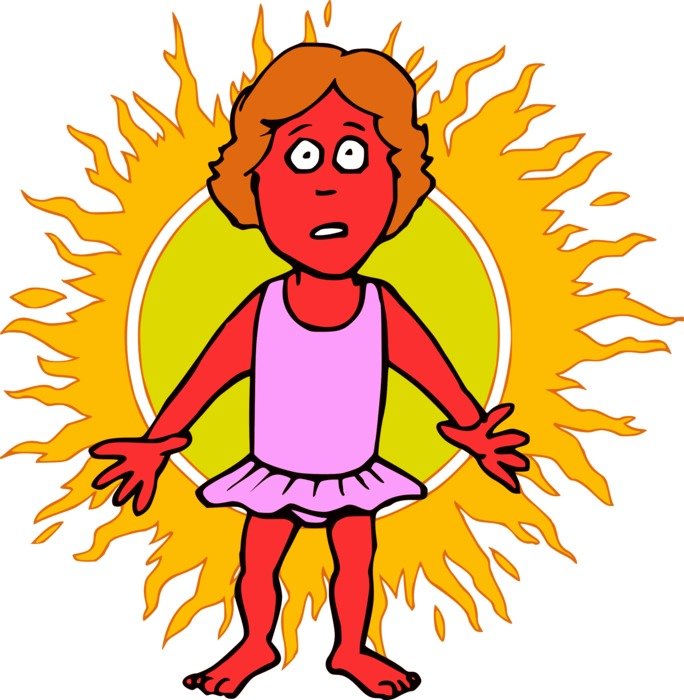 Clip art of Sun Burn