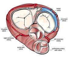 Mechanical Heart Valve