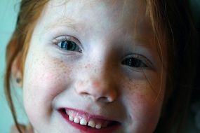 girl with freckles