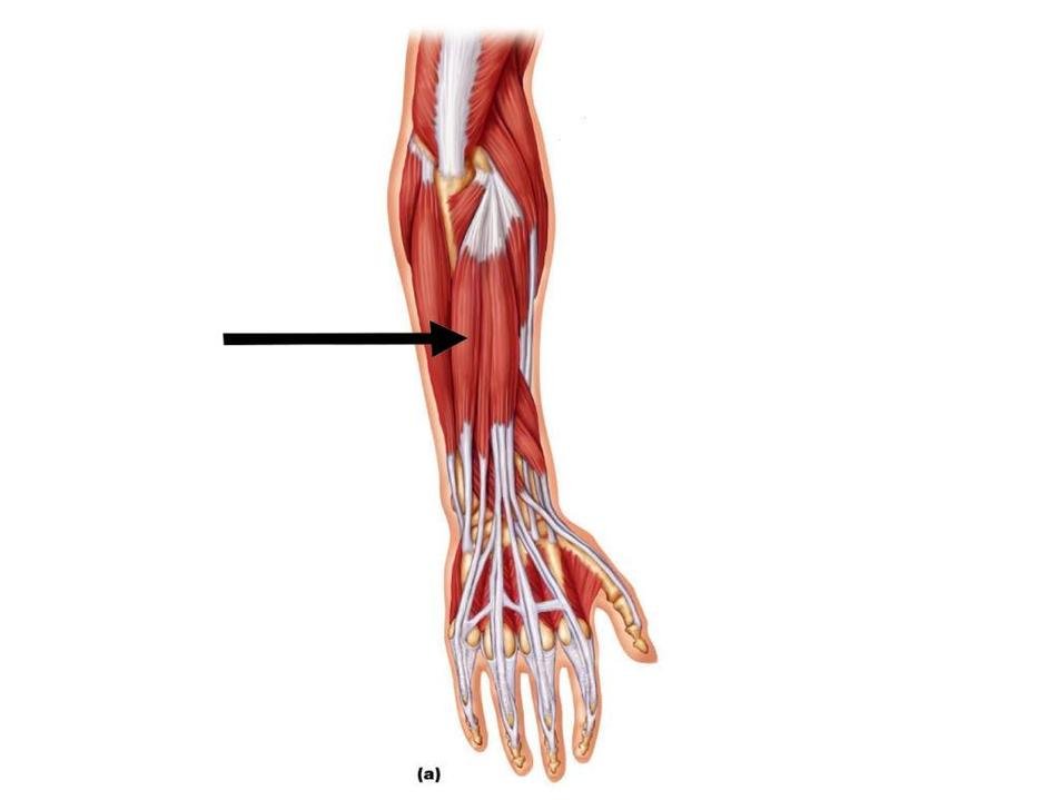 Extensor Carpi Ulnaris drawing