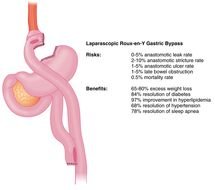 ICD 9 Coding Clip Art
