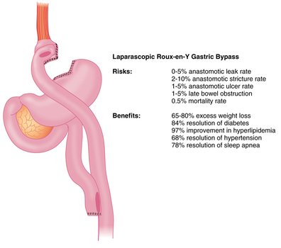 ICD 9 Coding Clip Art