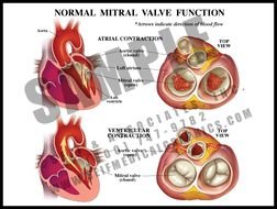 Mitral Valve