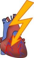Heart Attack Clip Art N15