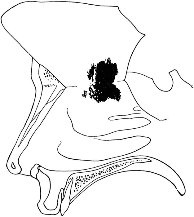 painted Mucous Membrane