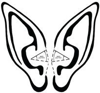 Elf Ears