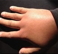 Fat Hands