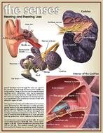 Hearing Loss N3