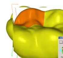 Model Tooth Surface