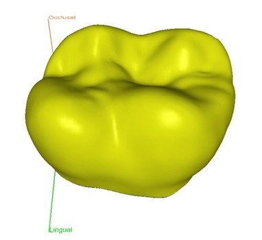 Model Tooth Surface