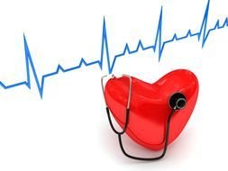 Heart Attack, concept, stethoscope on heart