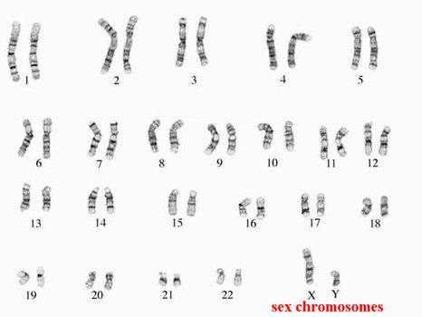 Human Karyotype