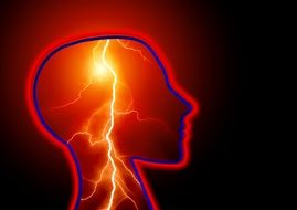 lightning in the head