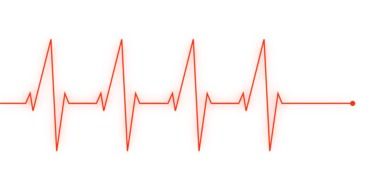 human heartbeat cardiogram