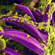 violet bacteria under microscope