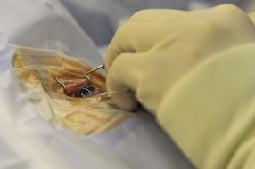 medical surgery operation process