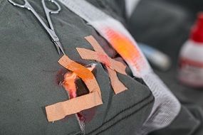 elastoplast on a wound