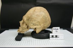 skull of a man