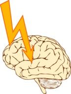 epilepsy seizure stroke drawing