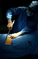 Photo of surgery operation