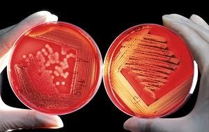 agar breeding