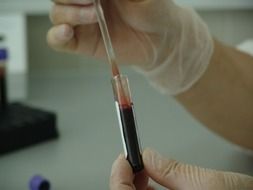 blood vial analysis