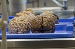 the brain medical science