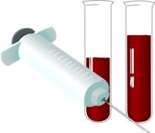lab syringe and test tubes