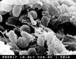 scanning through an electron microscope