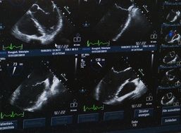 Photo of x ray images