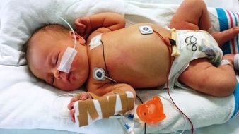 newborn sick baby medical health