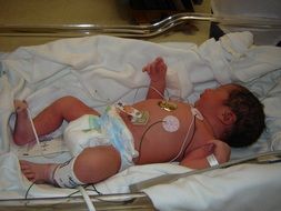 resuscitation for newborns