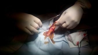 suture on the finger