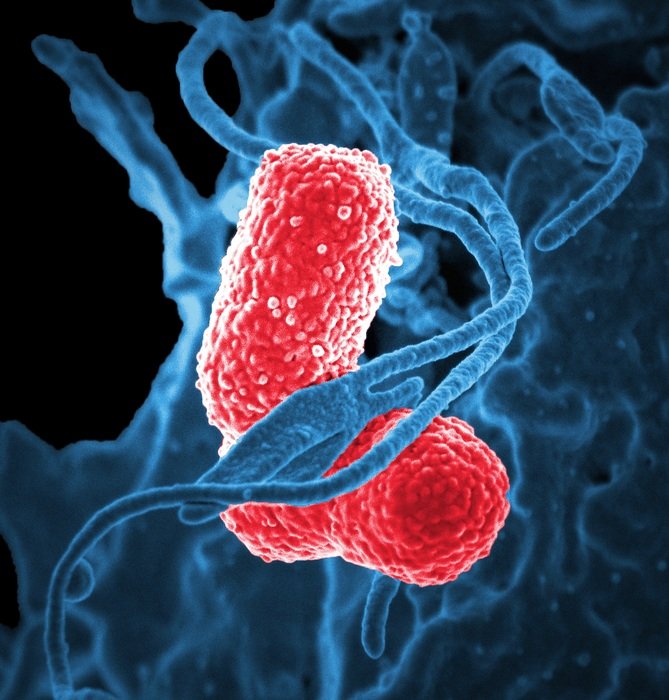 Red klebsiella pneumoniae bacteria under the microscope