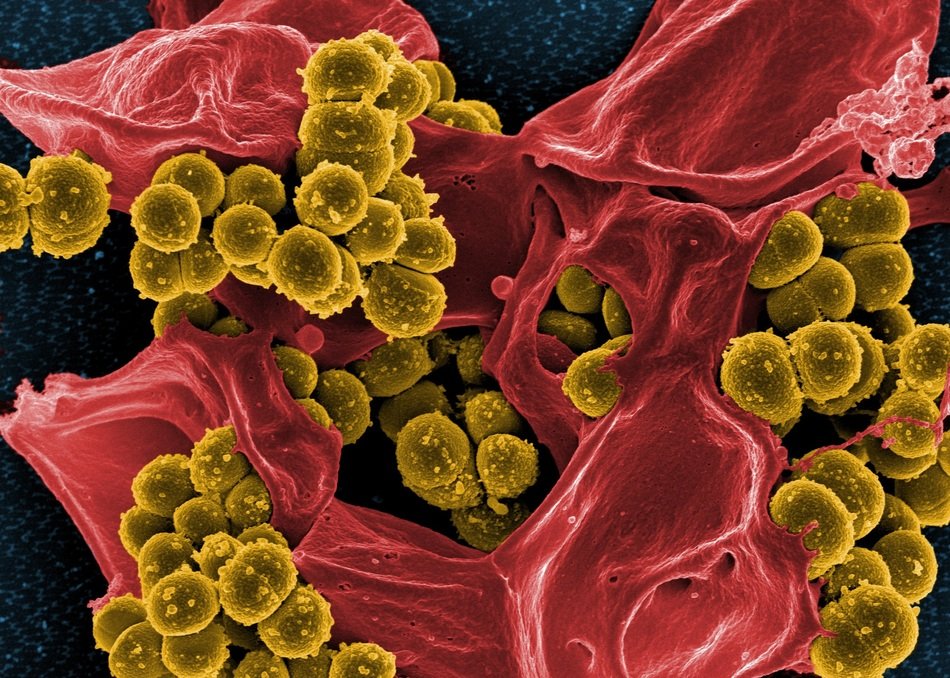 Clipart of staphylococcus aureus