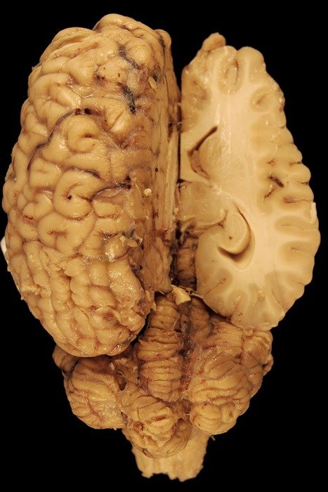 anatomy of a equine brain