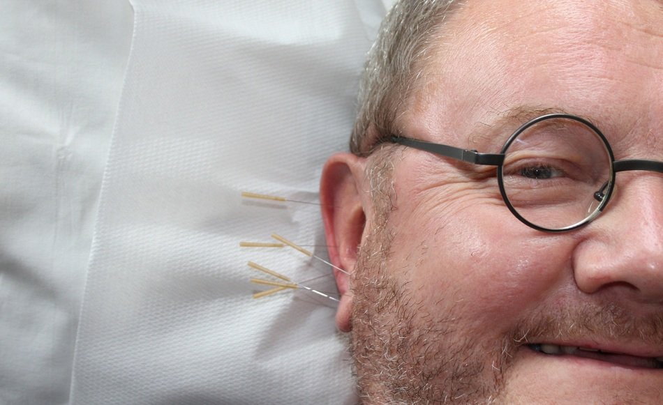 medical needles in the ear of a man with the glasses