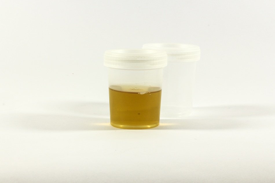 the urine test container