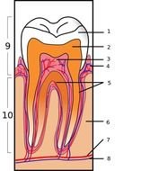 Tooth Extraction Clip Art N2