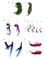 Homozygous Heterozygous