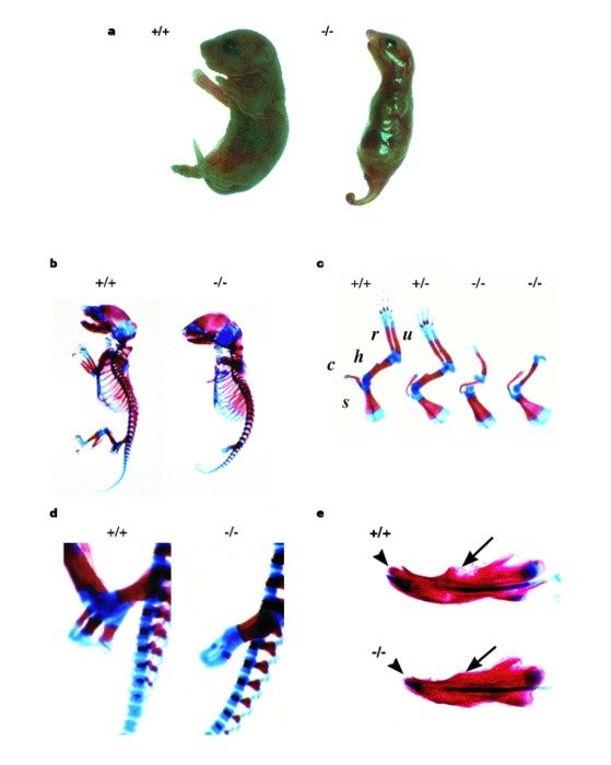 Homozygous Heterozygous