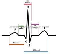 Printable EKG Rhythm Strips Examples